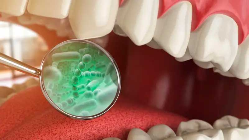 Las bacterias de la boca son causa de cuatro enfermedades